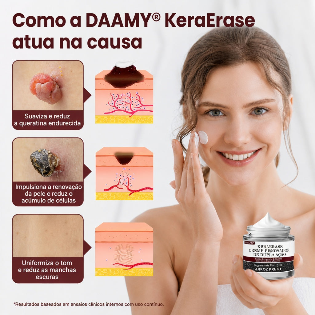👨‍⚕️🌿𝑫𝑨𝑨𝑴𝒀® KeraErase Creme Renovador de Dupla Ação