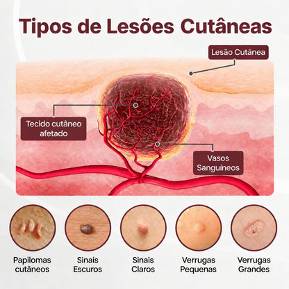 👨‍⚕️🌿𝑫𝑨𝑨𝑴𝒀® KeraErase Creme Renovador de Dupla Ação