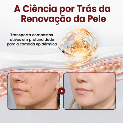👨‍⚕️🌿𝑫𝑨𝑨𝑴𝒀® KeraErase Creme Renovador de Dupla Ação