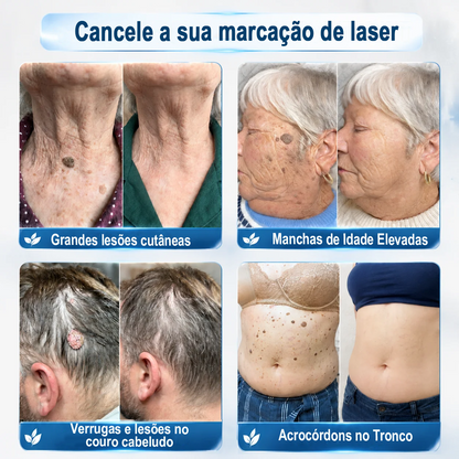 𝑷𝒖𝒓𝒆𝒍𝒖𝒙𝒐® Caneta Roll-on Premium🌿
