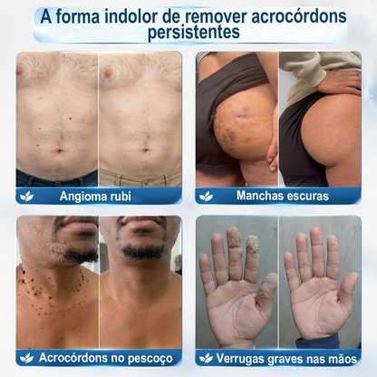 𝑷𝒖𝒓𝒆𝒍𝒖𝒙𝒐® Caneta Roll-on Premium🌿